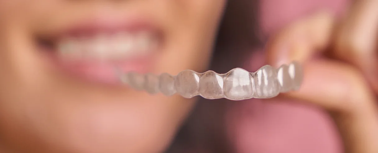 The Complete Guide to Invisalign